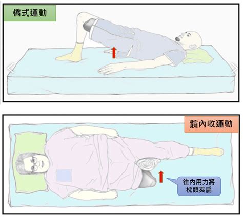 截刀臥位|一位年輕直腸癌個案之 手術全期護理經驗